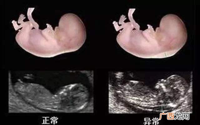 产后产检查什么项目 产后需要做哪些检查项目