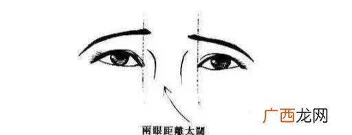 内眼角和外眼角 开内眼角和外眼角哪个风险大