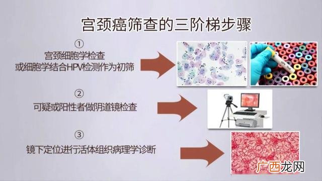做宫颈筛查都做什么,宫颈筛查有哪些检查项目