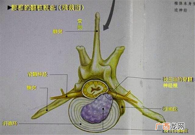 小狗突然瘫痪有办法治好吗,狗狗双腿瘫痪了怎么办