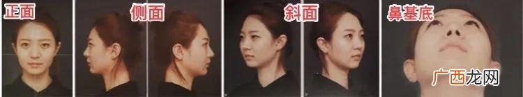 安全的医美项目有哪些,医美美容有哪些项目