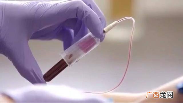 正常内分泌六项报告单,女性内分泌激素六项检查