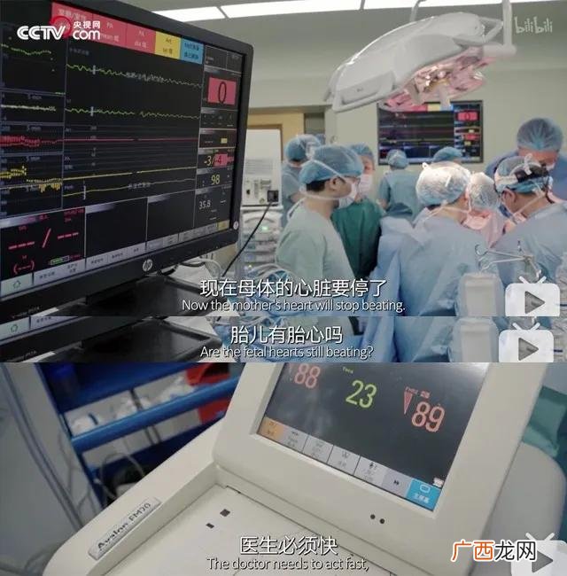 创业时候看到蛇啥寓意,创业梦见蛇