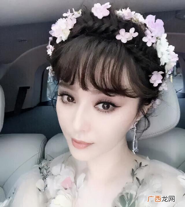 开内眼角留疤真人照片 开眼角图片