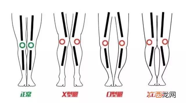 改善xo型腿最有效的动作,改善型创业有哪些