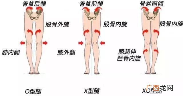 改善xo型腿最有效的动作,改善型创业有哪些