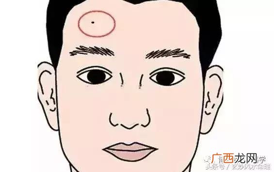 痣长在哪里不好,创业痣长什么位置