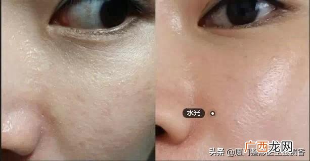 医美最基本的有哪些项目 医美项目有哪些