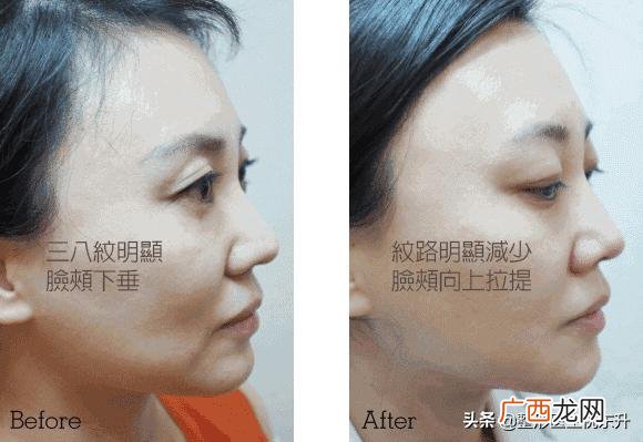 美容都有哪些项目可做,什么项目需要做地灾