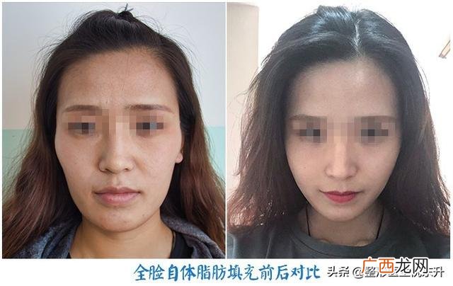 美容都有哪些项目可做,什么项目需要做地灾