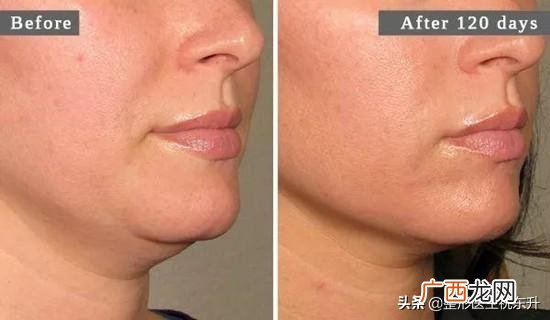 美容都有哪些项目可做,什么项目需要做地灾