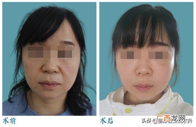 美容都有哪些项目可做,什么项目需要做地灾