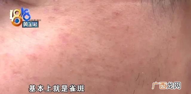 美容院祛斑价目表图片 美容院祛斑项目